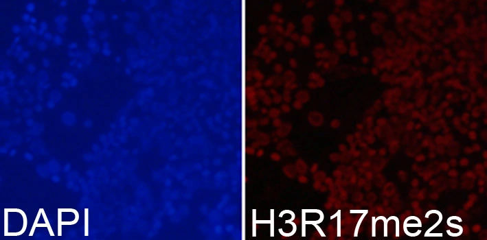 ICC/IF analysis of 293T cells using GTX33907 Histone H3R17me2 (Symmetric Di-methyl Arg17) antibody. Blue : DAPI