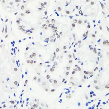 IHC-P analysis of human stomach tissue using GTX33907 Histone H3R17me2 (Symmetric Di-methyl Arg17) antibody. Dilution : 1:100