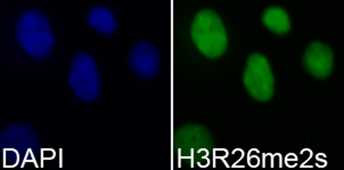Dot blot analysis of all sorts of methylation peptides using GTX33908 Histone H3R26me2 (Symmetric dimethyl Arg26) antibody.