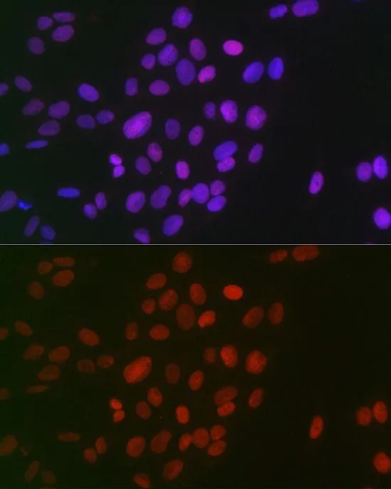 ICC/IF analysis of U2OS cells using GTX33908 Histone H3R26me2 (Symmetric Di-methyl Arg26) antibody. Blue : DAPI Dilution : 1:100