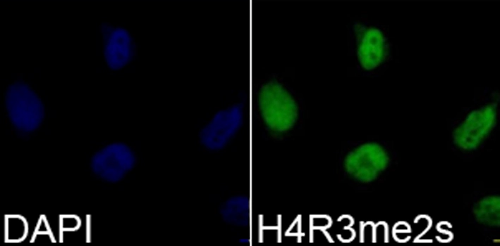 ICC/IF analysis of 293T cells using GTX33909 Histone H4R3me2 (Symmetric dimethyl Arg3) antibody. Blue : DAPI