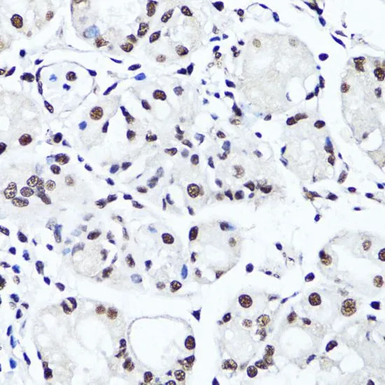 IHC-P analysis of human stomach tissue using GTX33909 Histone H4R3me2 (Symmetric dimethyl Arg3) antibody. Dilution : 1:100