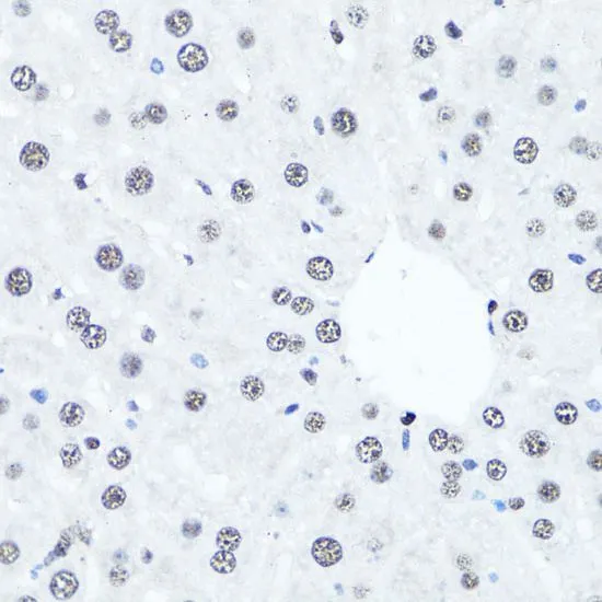 IHC-P analysis of mouse liver tissue using GTX33909 Histone H4R3me2 (Symmetric dimethyl Arg3) antibody. Dilution : 1:100