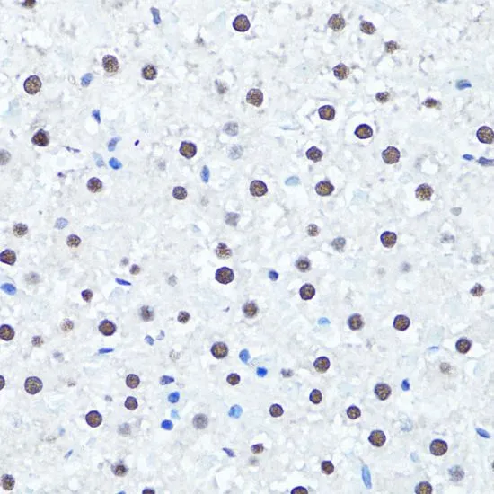 IHC-P analysis of rat liver tissue using GTX33909 Histone H4R3me2 (Symmetric dimethyl Arg3) antibody. Dilution : 1:100