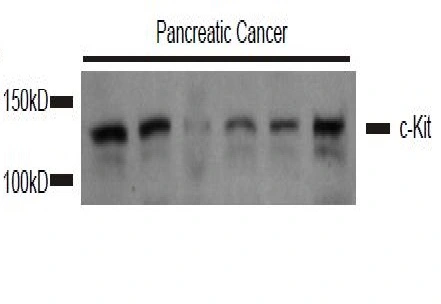 WB analysis of mouse pancreatic cancer tissue lysate using GTX33947 c-Kit antibody. Dilution : 1:1000