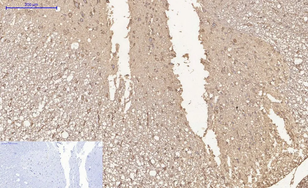 IHC-P analysis of rat spinal cord tissue using GTX33988 HDAC1 antibody [4E1]. Negative control (the lower left coner) was secondary antibody only. Antigen retrieval : Sodium citrate pH6.0 was used for antibody retrieval (>98oC, 20min) Dilution : 1:200