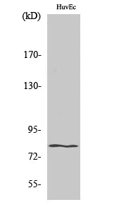 WB analysis of HuvEc cell lysate using GTX33990 HIPK4 antibody. WB analysis of HuvEc cell lysate using GTX33990 HIPK4 antibody.
