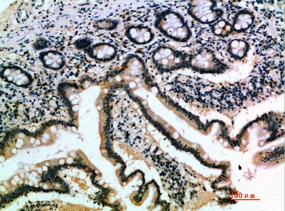 IHC-P analysis of human small intestine tissue using GTX34010 IL17B antibody. Dilution : 1:200 IHC-P analysis of human small intestine tissue using GTX34010 IL17B antibody. Dilution : 1:200