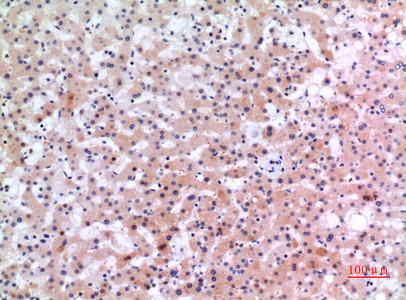 IHC-P analysis of human liver tissue using GTX34017 Inhibin beta E chain antibody. Dilution : 1:100