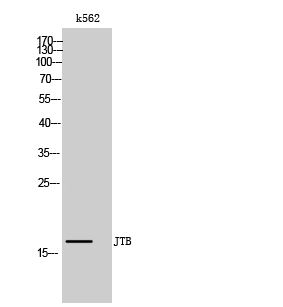 WB analysis of K562 cell lysate using GTX34021 JTB antibody. WB analysis of K562 cell lysate using GTX34021 JTB antibody.