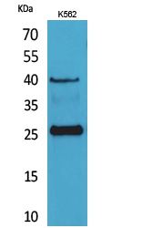 WB analysis of K562 cell lysate using GTX34026 CD161 antibody. WB analysis of K562 cell lysate using GTX34026 CD161 antibody.