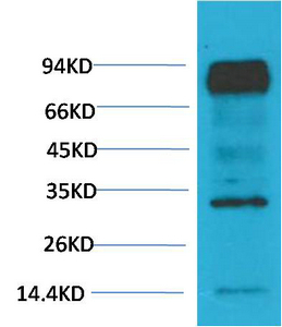 WB analysis of mouse brain tissue lysate using GTX34039 HIF1 beta antibody [4C5]. Dilution : 1:2000