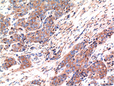 IHC-P analysis of mouse kidney tissue using GTX34053 Bax antibody [1C1]. Dilution : 1:200