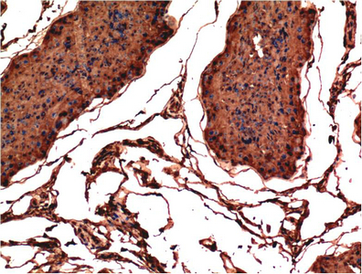 IHC-P analysis of rat testis tissue using GTX34053 Bax antibody [1C1]. Dilution : 1:200