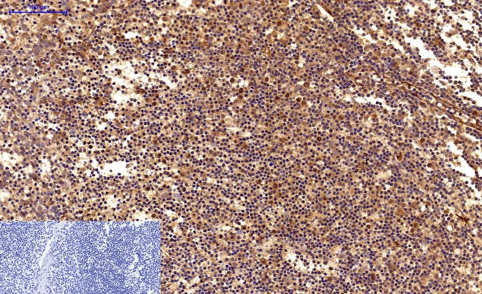 IHC-P analysis of human tonsil tissue using GTX34059 Survivin antibody [Mix]. Negative control (the lower left coner) was secondary antibody only. Antigen retrieval : Sodium citrate pH6.0 was used for antibody retrieval (>98oC, 20min) Dilution : 1:200