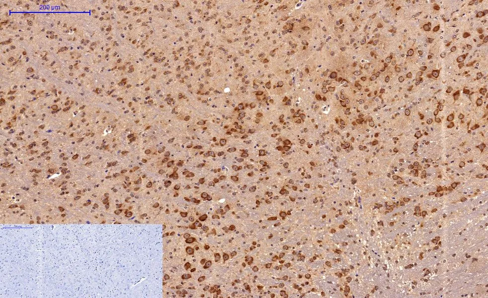 IHC-P analysis of mouse brain tissue using GTX34059 Survivin antibody [Mix]. Negative control (the lower left coner) was secondary antibody only. Antigen retrieval : Sodium citrate pH6.0 was used for antibody retrieval (>98oC, 20min) Dilution : 1:200