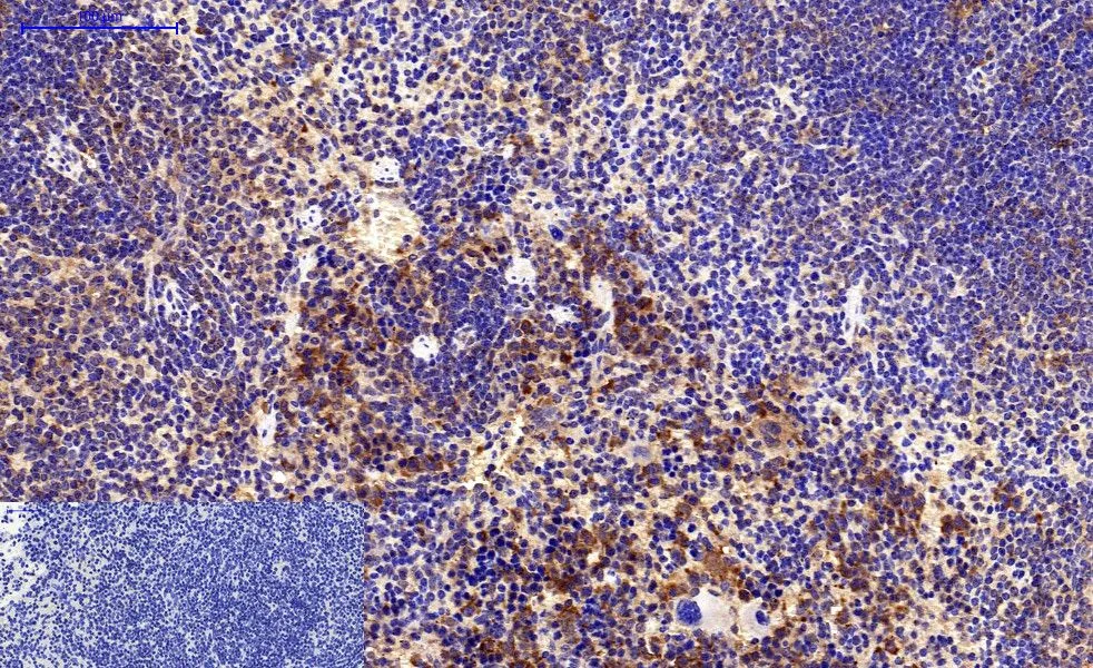 IHC-P analysis of mouse spleen tissue using GTX34059 Survivin antibody [Mix]. Negative control (the lower left coner) was secondary antibody only. Antigen retrieval : Sodium citrate pH6.0 was used for antibody retrieval (>98oC, 20min) Dilution : 1:200