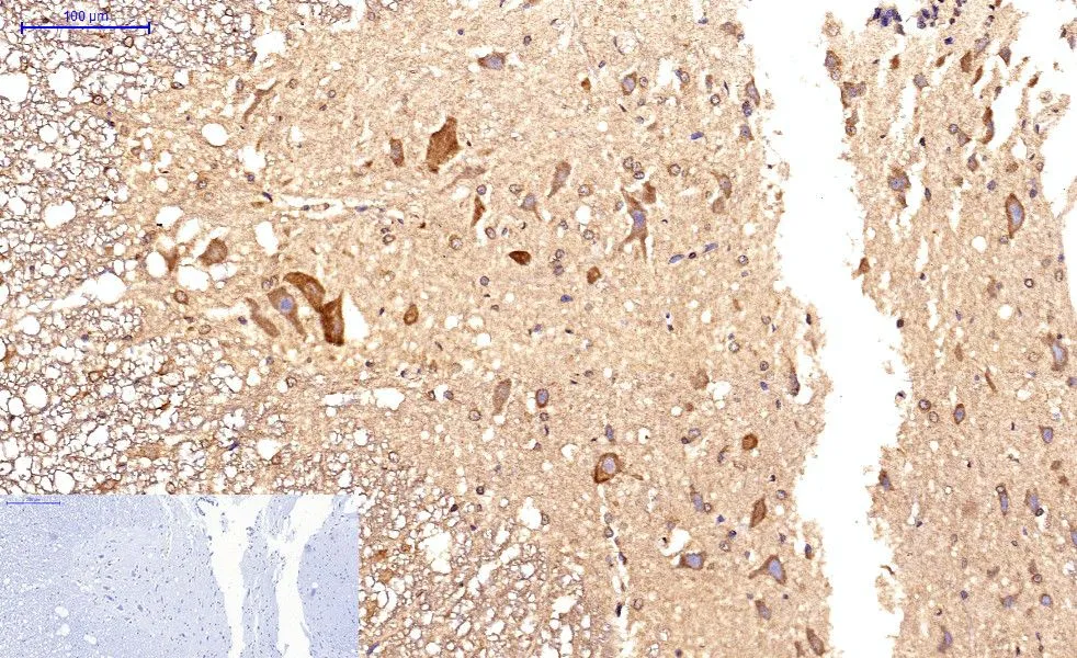 IHC-P analysis of rat spinal cord tissue using GTX34059 Survivin antibody [Mix]. Negative control (the lower left coner) was secondary antibody only. Antigen retrieval : Sodium citrate pH6.0 was used for antibody retrieval (>98oC, 20min) Dilution : 1:200
