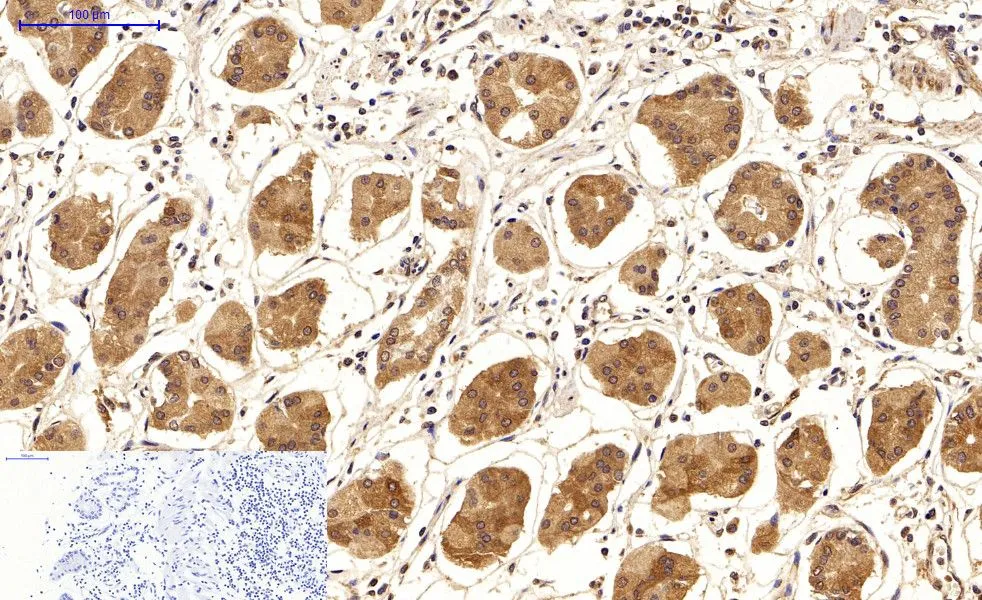 IHC-P analysis of human stomach tissue using GTX34067 LC3A antibody [5G10]. Negative control (the lower left coner) was secondary antibody only. Antigen retrieval : Sodium citrate pH6.0 was used for antibody retrieval (>98oC, 20min) Dilution : 1:200