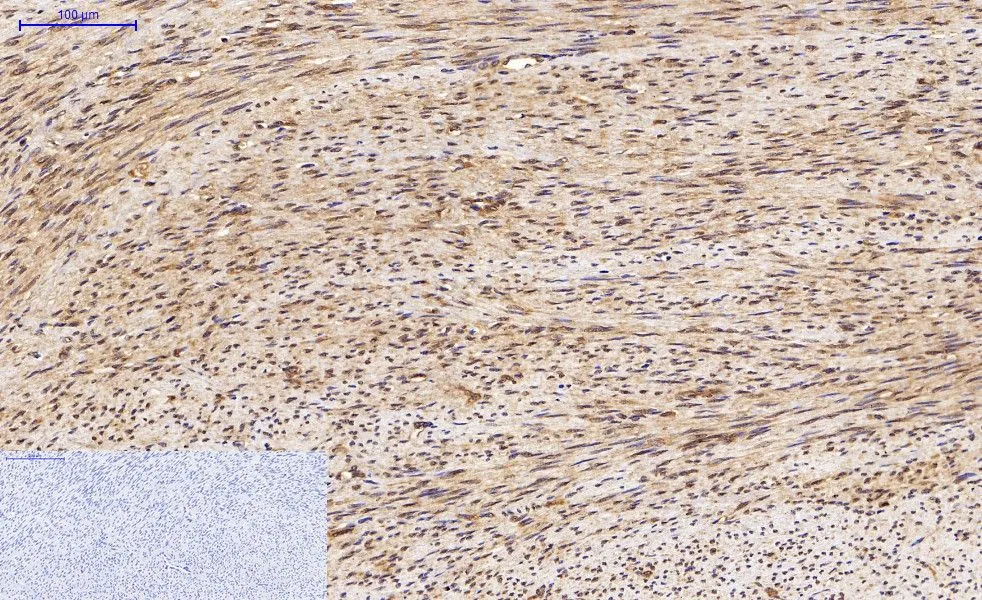 IHC-P analysis of human uterus tissue using GTX34067 LC3A antibody [5G10]. Negative control (the lower left coner) was secondary antibody only. Antigen retrieval : Sodium citrate pH6.0 was used for antibody retrieval (>98oC, 20min) Dilution : 1:200