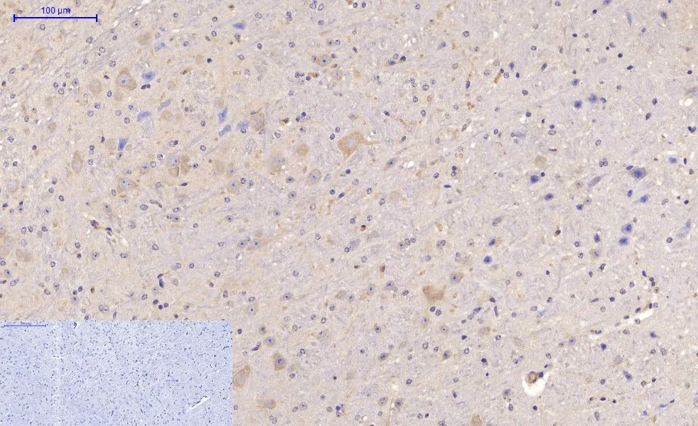 IHC-P analysis of mouse brain tissue using GTX34069 MAP2 antibody [7D4]. Negative control (the lower left coner) was secondary antibody only. Antigen retrieval : Sodium citrate pH6.0 was used for antibody retrieval (>98oC, 20min) Dilution : 1:200