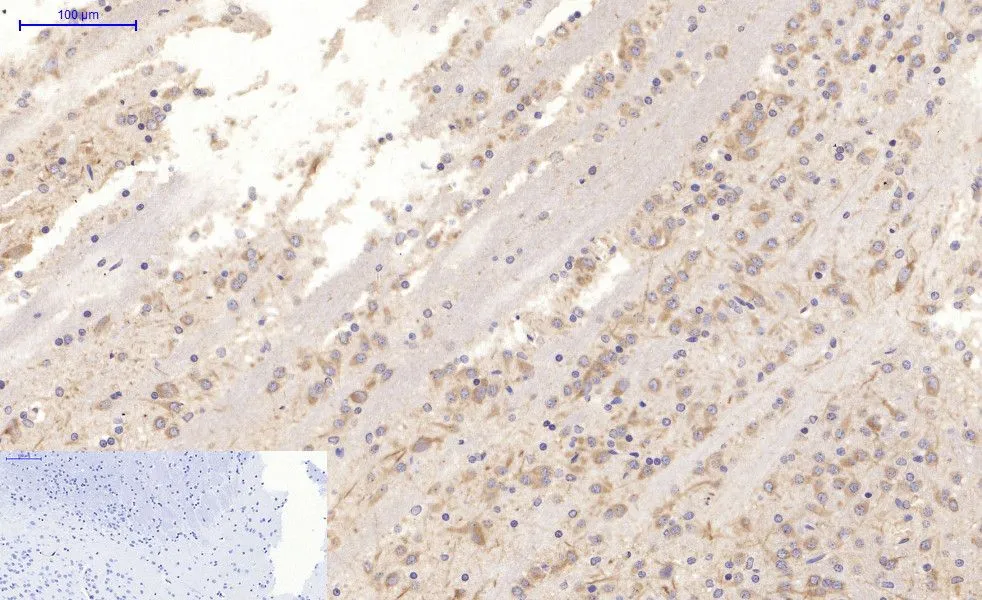 IHC-P analysis of rat brain tissue using GTX34069 MAP2 antibody [7D4]. Negative control (the lower left coner) was secondary antibody only. Antigen retrieval : Sodium citrate pH6.0 was used for antibody retrieval (>98oC, 20min) Dilution : 1:200