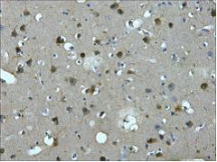 IHC-P analysis of human brain tissue using GTX34069 MAP2 antibody [7D4]. Dilution : 1:200
