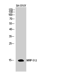 WB analysis of SH-SY5Y cell lysate using GTX34089 MRPS12 antibody. WB analysis of SH-SY5Y cell lysate using GTX34089 MRPS12 antibody.