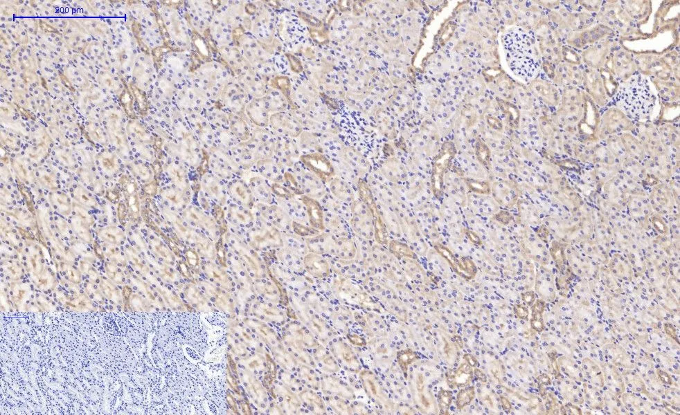 IHC-P analysis of rat kidney tissue using GTX34098 IKB beta antibody [1F3]. Negative control (the lower left coner) was secondary antibody only. Antigen retrieval : Sodium citrate pH6.0 was used for antibody retrieval (>98oC, 20min) Dilution : 1:200