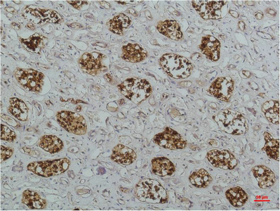 IHC-P analysis of human kidney tissue using GTX34098 IKB beta antibody [1F3]. Dilution : 1:200