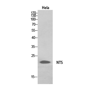 Western Blot (WB) analysis of HeLa,HepG2 cells using Neurotensin Polyclonal Antibody.