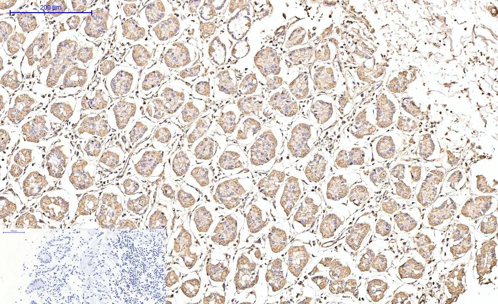 IHC-P analysis of human stomach tissue using GTX34111 alpha Smooth Muscle Actin antibody [6A12]. Negative control (the lower left coner) was secondary antibody only. Antigen retrieval : Sodium citrate pH6.0 was used for antibody retrieval (>98oC, 20min) Dilution : 1:200
