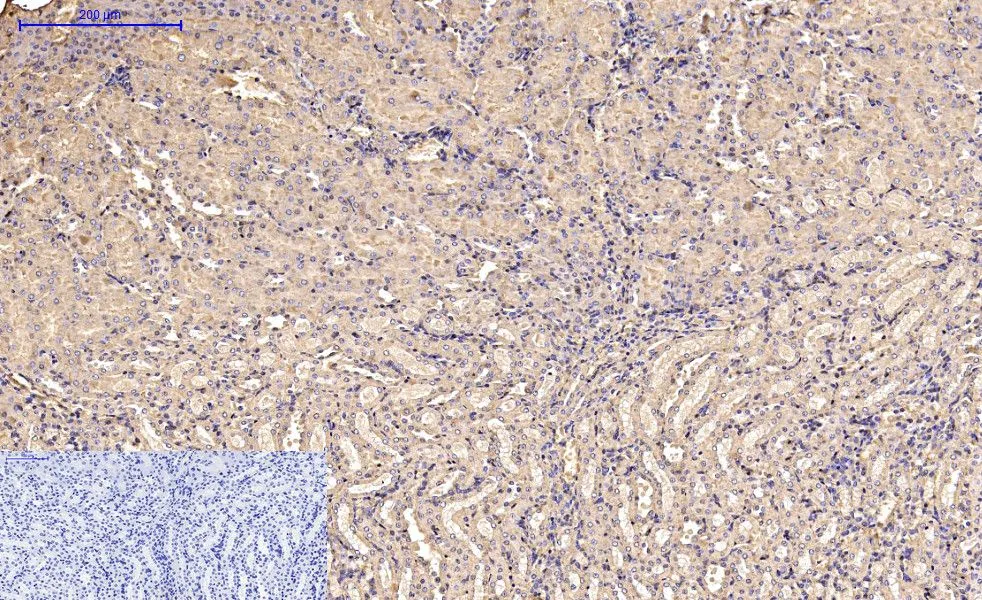 IHC-P analysis of mouse kidney tissue using GTX34111 alpha Smooth Muscle Actin antibody [6A12]. Negative control (the lower left coner) was secondary antibody only. Antigen retrieval : Sodium citrate pH6.0 was used for antibody retrieval (>98oC, 20min) Dilution : 1:200