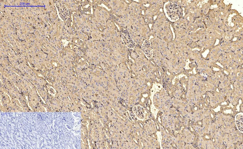 IHC-P analysis of rat kidney tissue using GTX34111 alpha Smooth Muscle Actin antibody [6A12]. Negative control (the lower left coner) was secondary antibody only. Antigen retrieval : Sodium citrate pH6.0 was used for antibody retrieval (>98oC, 20min) Dilution : 1:200