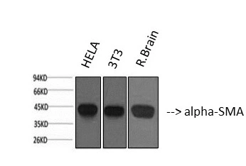 WB analysis of various sample lysates using GTX34111 alpha Smooth Muscle Actin antibody [6A12]. Lane 1 : HeLa cell lysate Lane 2 : 3T3 cell lysate Lane 3 : Rat brain tissue lysate