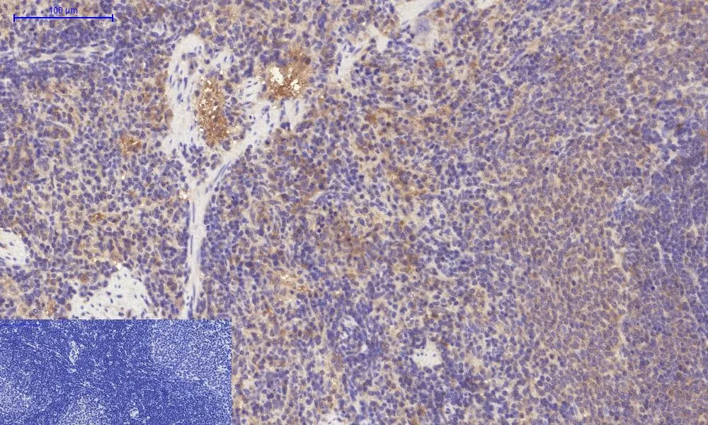 IHC-P analysis of rat spleen tissue using GTX34117 PDGF Receptor alpha antibody [7A3]. Negative control (the lower left coner) was secondary antibody only. Antigen retrieval : Sodium citrate pH6.0 was used for antibody retrieval (>98oC, 20min) Dilution : 1:200