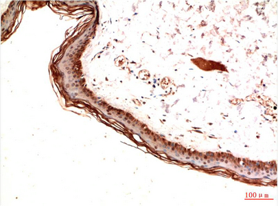 IHC-P analysis of human skin tissue using GTX34117 PDGF Receptor alpha antibody [7A3]. Dilution : 1:200