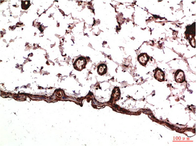 IHC-P analysis of rat skin tissue using GTX34117 PDGF Receptor alpha antibody [7A3]. Dilution : 1:200