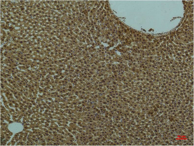 IHC-P analysis of rat liver tissue using GTX34122 PI3 kinase p85 alpha antibody [3B7]. Dilution : 1:200