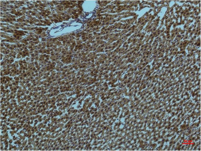 IHC-P analysis of rat liver tissue using GTX34123 PI3 kinase p85 alpha antibody [2D2]. Dilution : 1:200