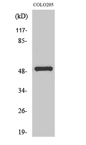 WB analysis of COLO205 cell lysate using GTX34138 PPP4R1L antibody. WB analysis of COLO205 cell lysate using GTX34138 PPP4R1L antibody.