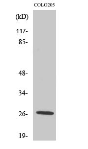 WB analysis of COLO205 cell lysate using GTX34148 PRSS33 antibody. WB analysis of COLO205 cell lysate using GTX34148 PRSS33 antibody.