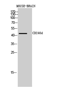 WB analysis of mouse brain cell lysate using GTX34162 RhD antibody. WB analysis of mouse brain cell lysate using GTX34162 RhD antibody.