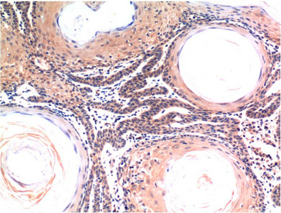 IHC-P analysis of human skin tissue using GTX34166 Caspase 3 antibody [5H10]. Dilution : 1:200