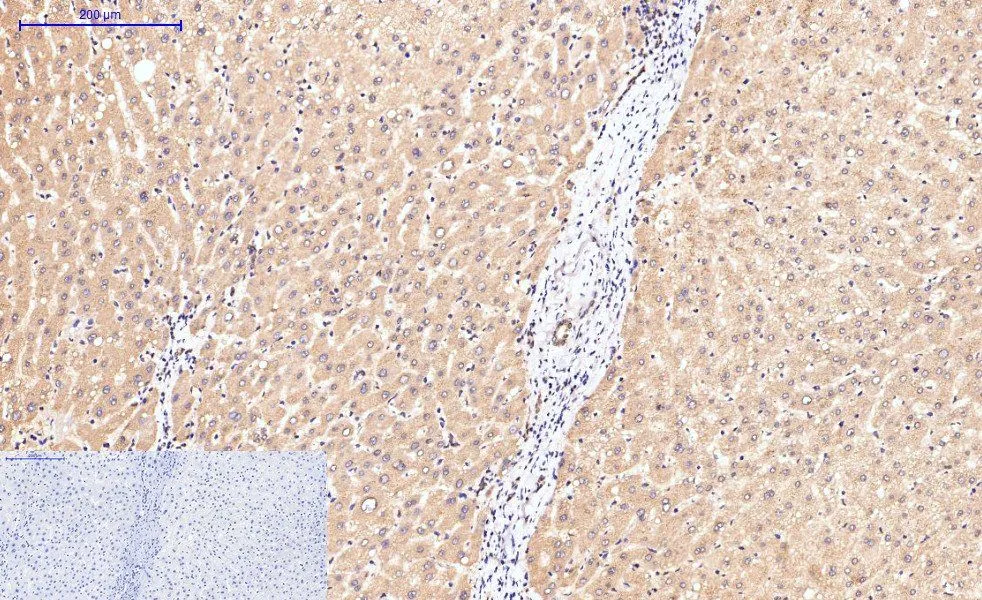 IHC-P analysis of human liver tissue using GTX34167 Caspase 8 antibody [2G12]. Negative control (the lower left coner) was secondary antibody only. Antigen retrieval : Sodium citrate pH6.0 was used for antibody retrieval (>98oC, 20min) Dilution : 1:200