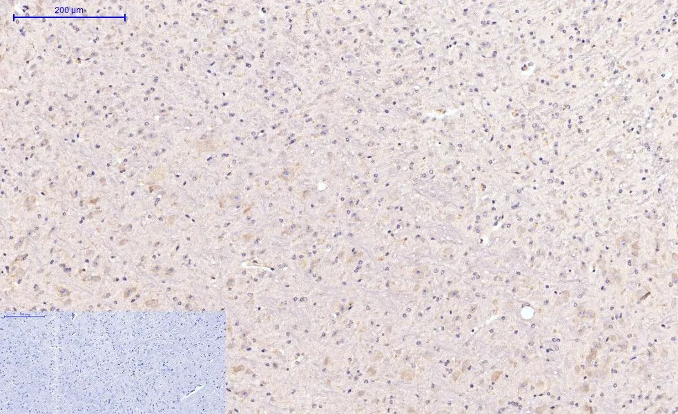 IHC-P analysis of mouse brain tissue using GTX34167 Caspase 8 antibody [2G12]. Negative control (the lower left coner) was secondary antibody only. Antigen retrieval : Sodium citrate pH6.0 was used for antibody retrieval (>98oC, 20min) Dilution : 1:200