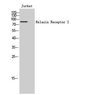Western Blot (WB) analysis of Jurkat cells using Relaxin Receptor 2 Polyclonal Antibody.
