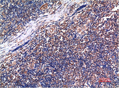 IHC-P analysis of human tonsil tissue using GTX34188 Cyclin B1 antibody [5C1]. Dilution : 1:200