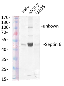 WB analysis of various cell lysates using GTX34192 SEPT6 antibody. Lane 1 : HeLa cell lysate Lane 2 : MCF-7 cell lysate Lane 3 : U2OS cell lysate