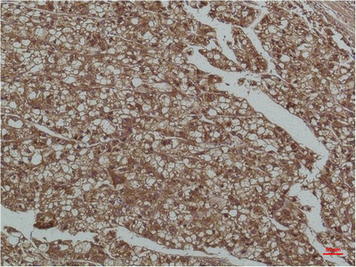 IHC-P analysis of human liver tissue using GTX34208 SMAD3 antibody [8B5]. Dilution : 1:200